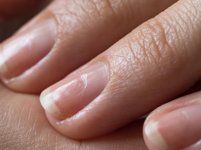 Photo of a Fingernail relating to fingernail Analysis
