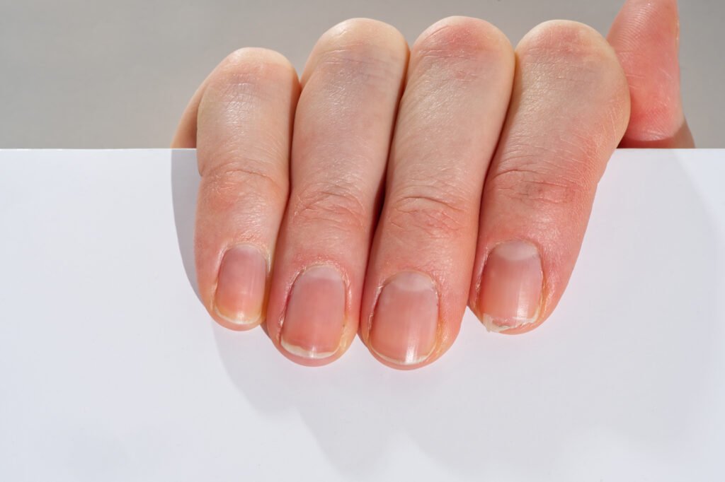 Fingernails used for fingernail analysis in Pam Rumley's World.