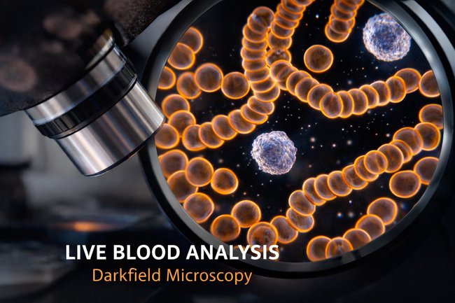 Darkfield microscopy image showing rouleaux formation of red blood cells and visible white blood cells during live blood analysis.